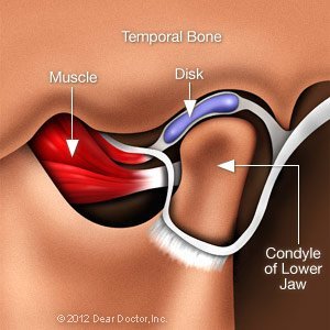 TMJ Joint.